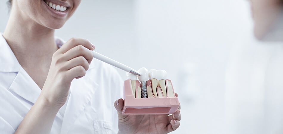 Dentist showing model of dental implant